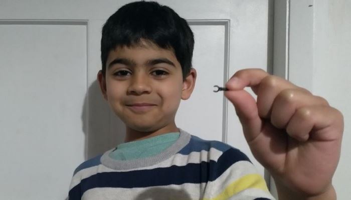 7 yaşındaki çocuğun burnuna sıkışan Lego parçası 2 sene sonra düştü