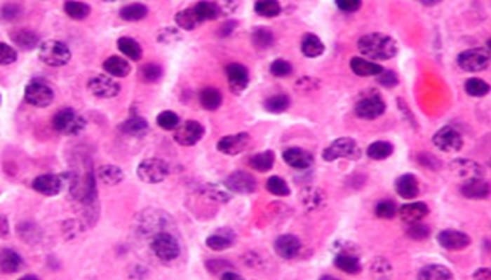 Ученые опробовали новое лекарство против стойкого рака