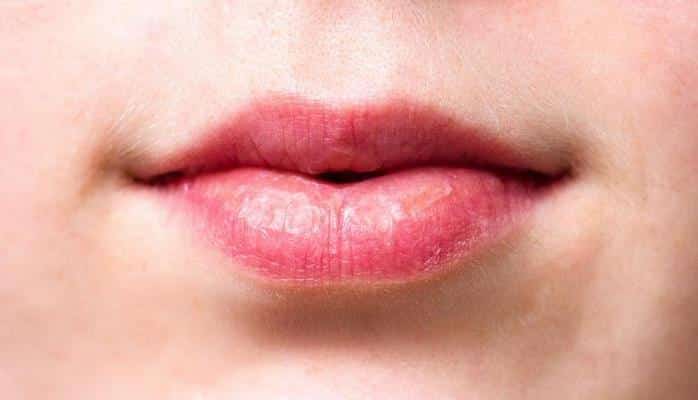 Учёные: По состоянию губ можно определить здоровье человека