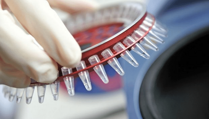 TƏBİB xəbərdarlıq edir: “Bir yoluxma halı 60-a yaxın insanı yoluxdurur”