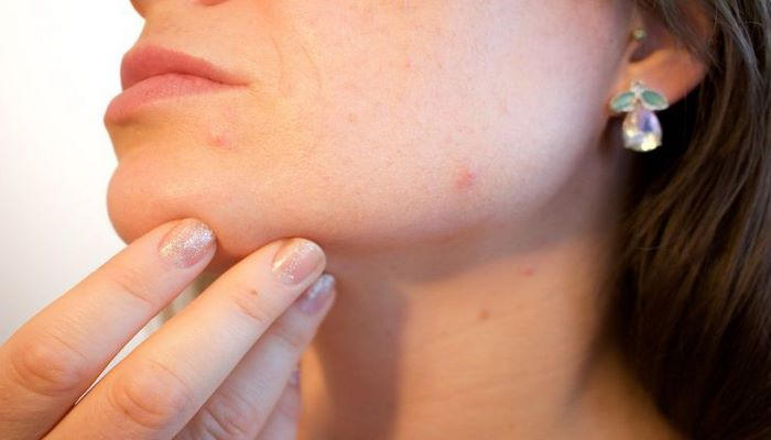 Медики рассказали, о каких болезнях говорит изменение оттенка кожи