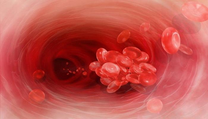 Первые признаки тромба: когда надо бежать к врачу