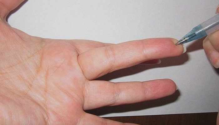 Qəfil təzyiqin qalxdıqda, bu nöqtəni sıx