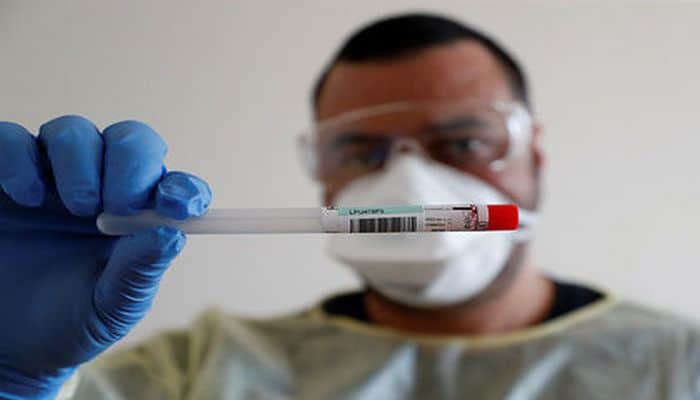 ABŞ-da koronavirusa qarşı vaksini heyvanlar üzərində sınaqdan keçirirlər