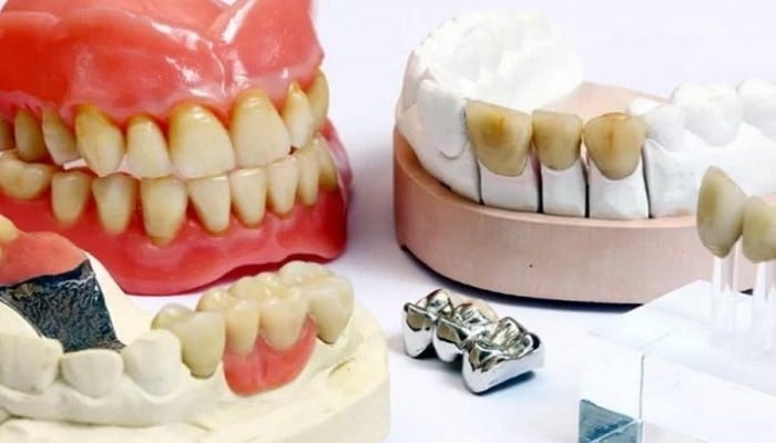 Diş “koronkaları” xərçəng yarada bilər