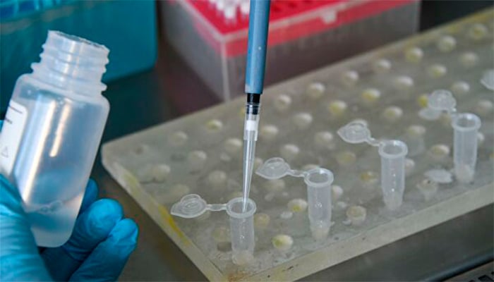 Эксперт: тест-полоски с золотом помогут диагностировать коронавирус 