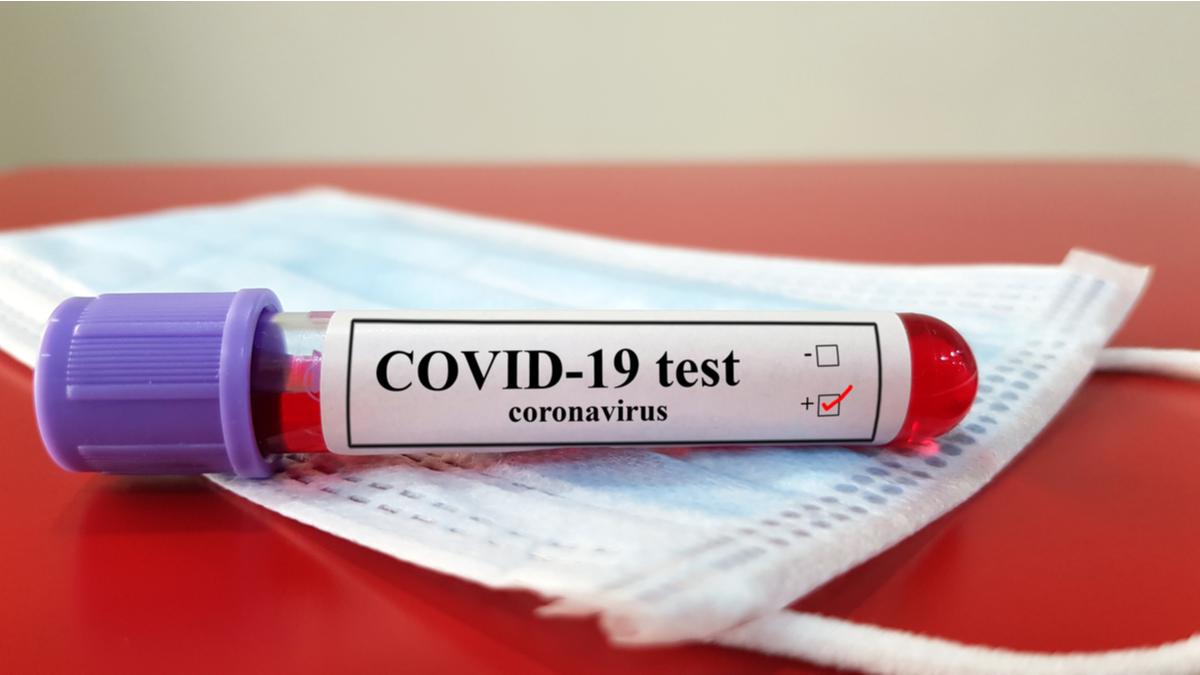 Azərbaycanda daha 318 nəfər koronavirusa yoluxub, 714 nəfər sağalıb