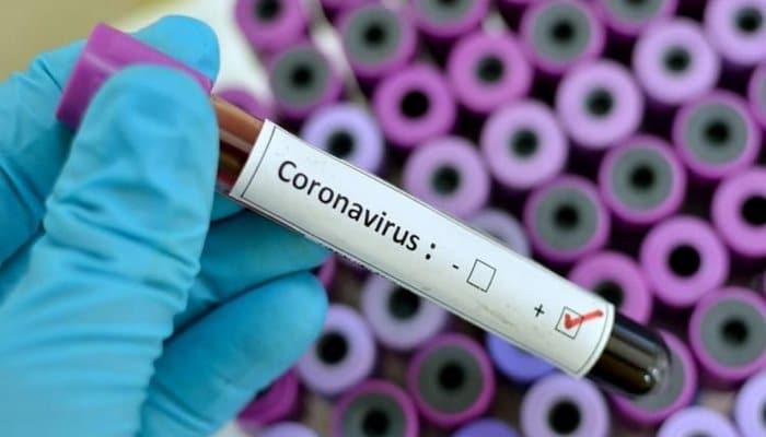 Türkiyədə daha 277 nəfər koronavirusa yoluxdu