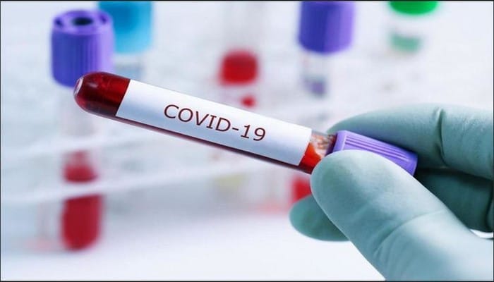 Azərbaycanda daha 15 nəfərdə koronavirus aşkarlandı