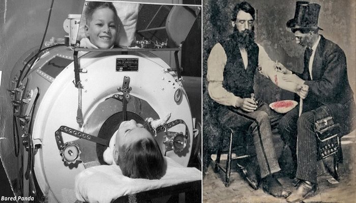 Keçmiş tibb haqqında faktları bildikdən sonra müasir həkimlərə hörmətiniz artacaq