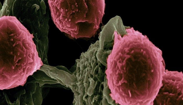 Найден «тормоз» иммунитета против рака