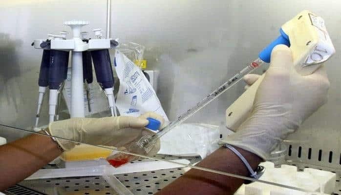 Qan damarlarının bərpasına kömək edə biləcək yeni hüceyrələr kəşf olunub