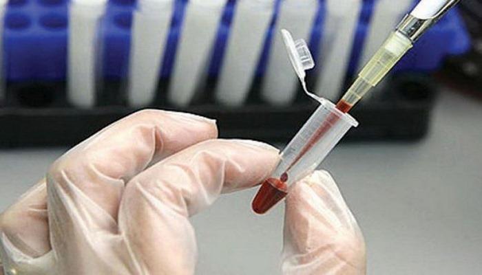 30 dəqiqədə bakteriya ölçən cihaz - Tibdə yeni kəşf