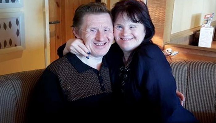 Dünyanın ilk Daun sindromlu evli cütlüyü – Gündə 100 dəfə “sevirəm” deyirlər