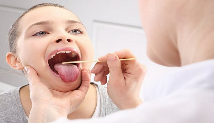 Глоссит – воспаление языка: виды, симптомы, лечение и советы