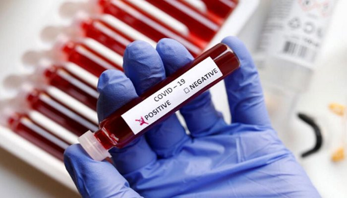 Bu əlamətlərdən biri varsa, təcili COVİD-19 analizi verin