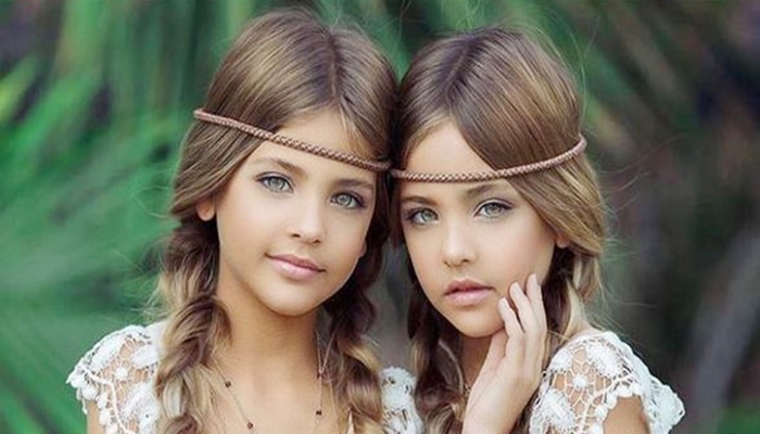 Dünyanın "ən gözəl əkizləri" oldular