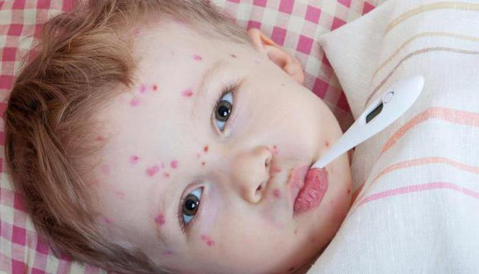 По мере потепления случаи заражения ветрянкой уменьшатся