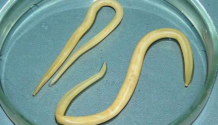 Böyüklərdə və yaşlılarda askarid əlamətləri – Bədənindəki qurdları tanı