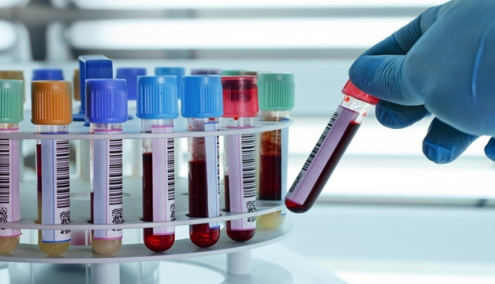 В октябре в Азербайджане у 19 желающих вступить в брак обнаружен СПИД