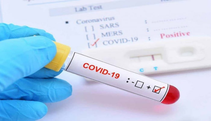 Allergik xəstələrdə COVID-19-a yoluxma zamanı ağırlaşma ola bilərmi? - AÇIQLAMA