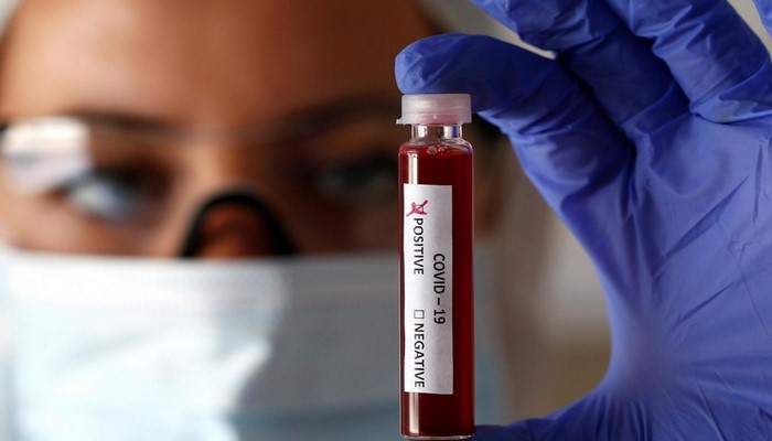 Azərbaycanda COVİD-19-un yeni ştamları aşkarlanıb?