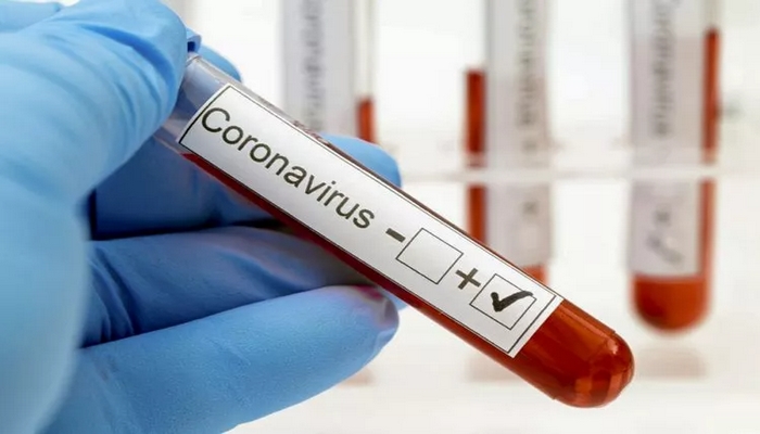 Azərbaycanda indiyədək 522 773 koronavirus testi aparılıb