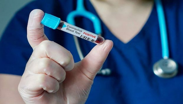 Azərbaycanda koronavirusa 4 451 yeni yoluxma qeydə alınıb, 39 nəfər vəfat edib