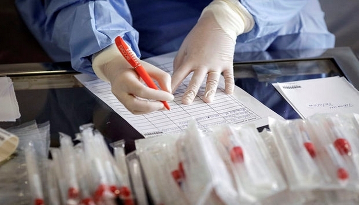 Azərbaycanda koronaviruslu xəstələrin müalicəsinə xərclənən vəsait açıqlandı- RƏSMİ