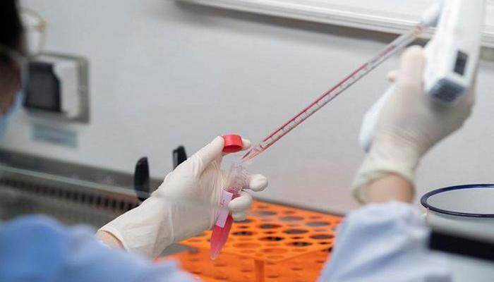 Azərbaycanda nazirliyin 26 əməkdaşı koronavirusa yoluxub, biri ölüb – RƏSMİ