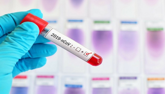 Azərbaycanda sutkalıq yoluxma sayı 100-ü ötdü