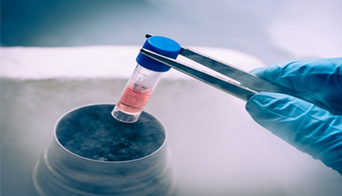 Parkinson xəstəliyinin müalicəsi üçün ilk dəfə gövdə hüceyrələri tətbiq edilib