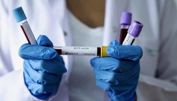 Ebola virusunu kəşf edən professorun Koronavirus şərhi: Kovid-19 daha təhlükəlidir