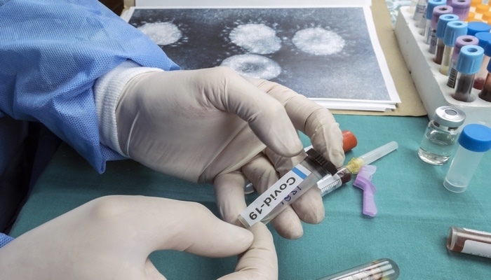 Koronavirus hansı xəstəliklərdən "qidalanır"?