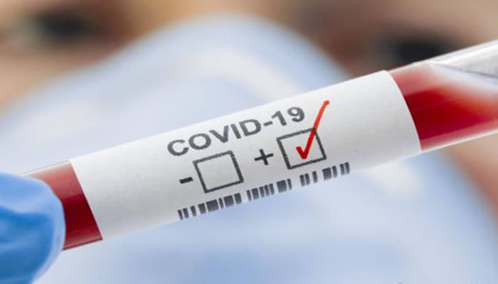 Koronavirusla bağlı 7 ən populyar sual - Almaniyalı həkim cavablandırır