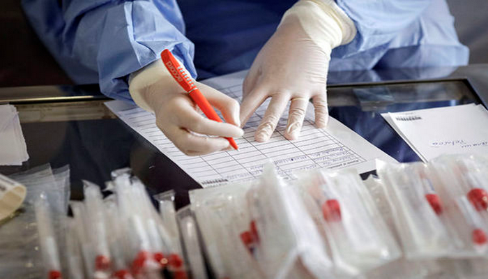 Hikmət Hacıyev pandemiyanın geniş yayılmasının əsas səbəbini açıqladı