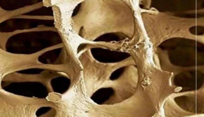 Sümüklərinizi vaxtından əvvəl məhv edən - 5 qida