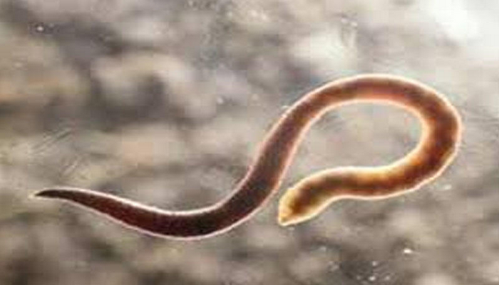 Bağırsaqdan kənar helmintozlar