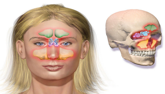 Baş beyin absesləri