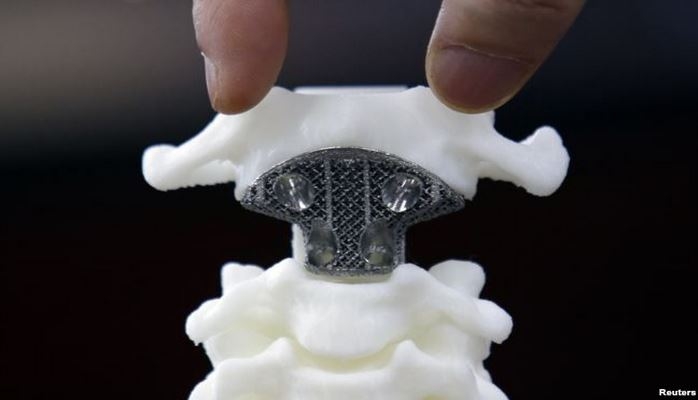 3D çap olunan sintetik sümük implantı