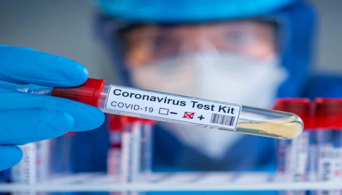 Azərbaycanda 4 759 nəfər koronavirusa yoluxub, 56-sı ölüb