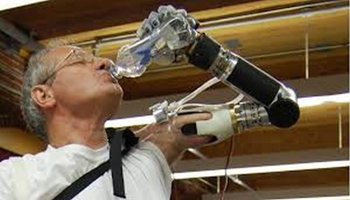 "Hissedebilen" Zihin Kontrollü Kol Protezleri Artık Günlük Yaşamın Bir Parçası!