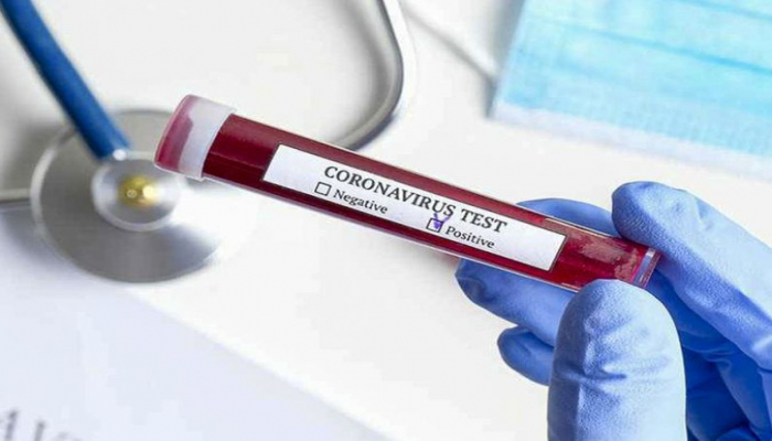 BMT-nin yüzə yaxın sülhməramlısı koronavirusa yoluxub