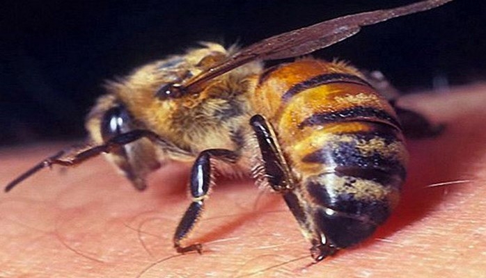 Arı sancmaları zamanı nə etməli?