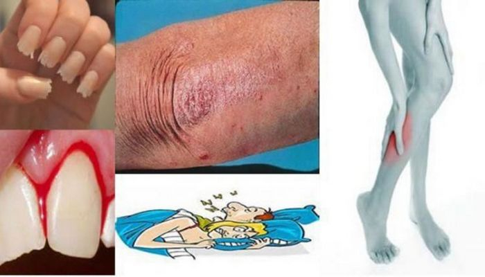 Orqanizmin yardıma ehtiyacı olduğunun 10 əlaməti