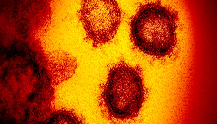Новой методике лечения коронавируса не нужны аппараты ИВЛ