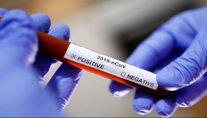 Gürcüstanda koronavirusa yoluxanların sayı 218 nəfərə çatıb