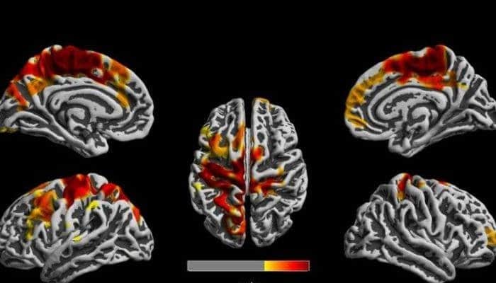 İnsan beyni üçün əsas təhlükə açıqlanıb