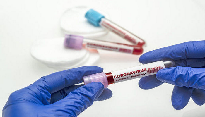 Azərbaycanda daha iki nəfər koronavirusdan öldü: 106 yeni yoluxma faktı - RƏSMİ