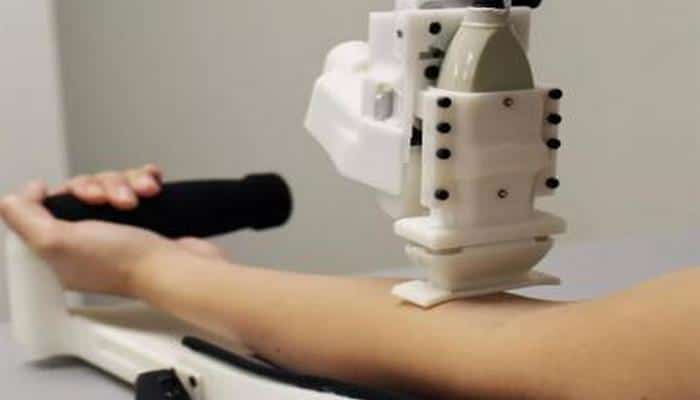 Qan almaq üçün robot